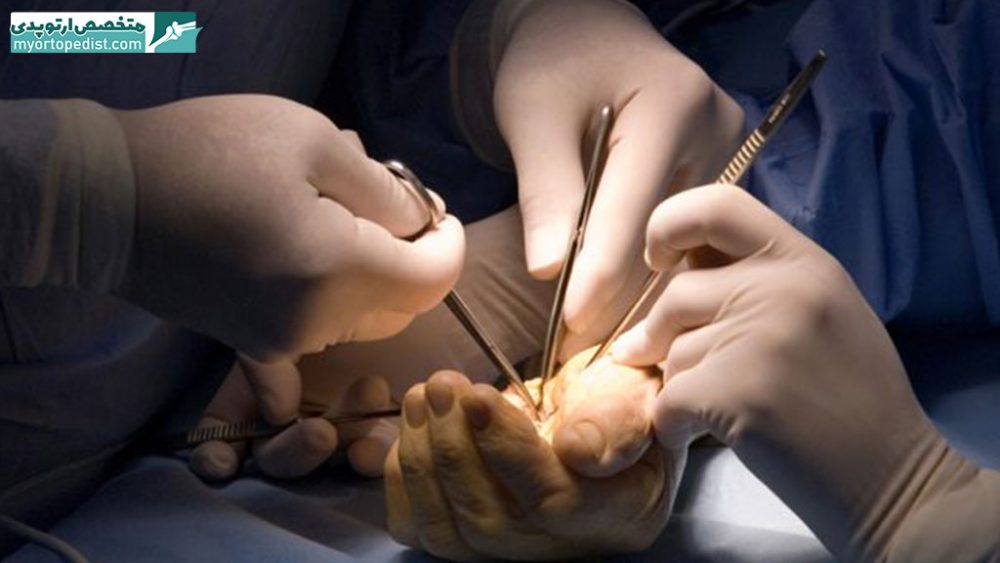 پزشکان فوق تخصص جراحی دست در شیراز