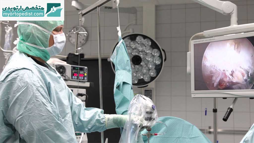 هزینه جراحی آرتروسکوپی آرنج در شیراز چقدر است؟